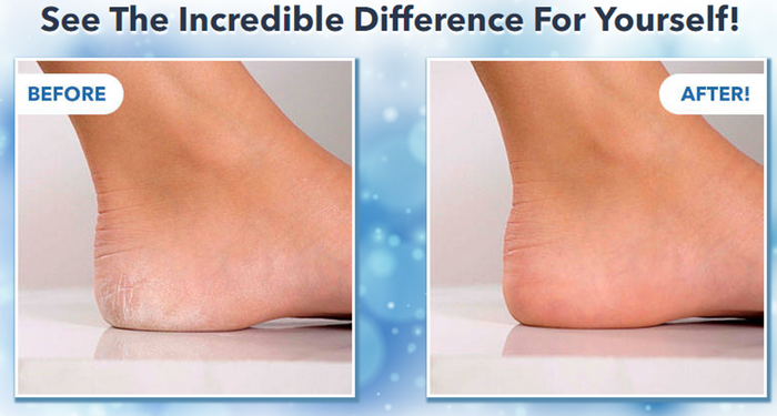 Pedi Air